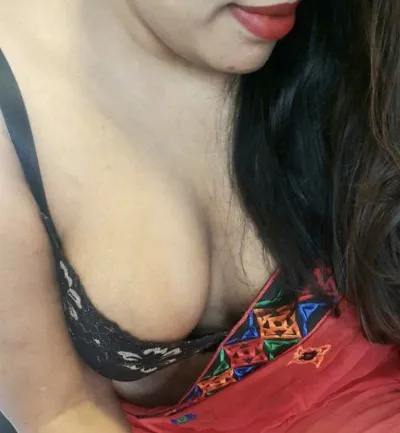 Dimple - Photo 2
